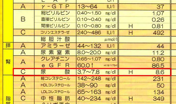 健康診断で尿酸値が高いことを示すデータ